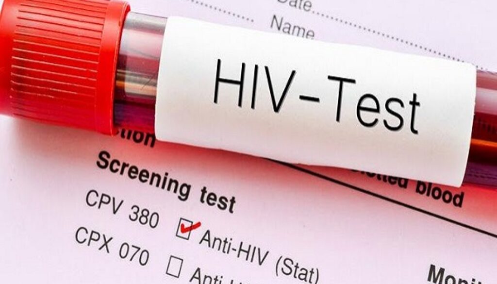 HIV-test