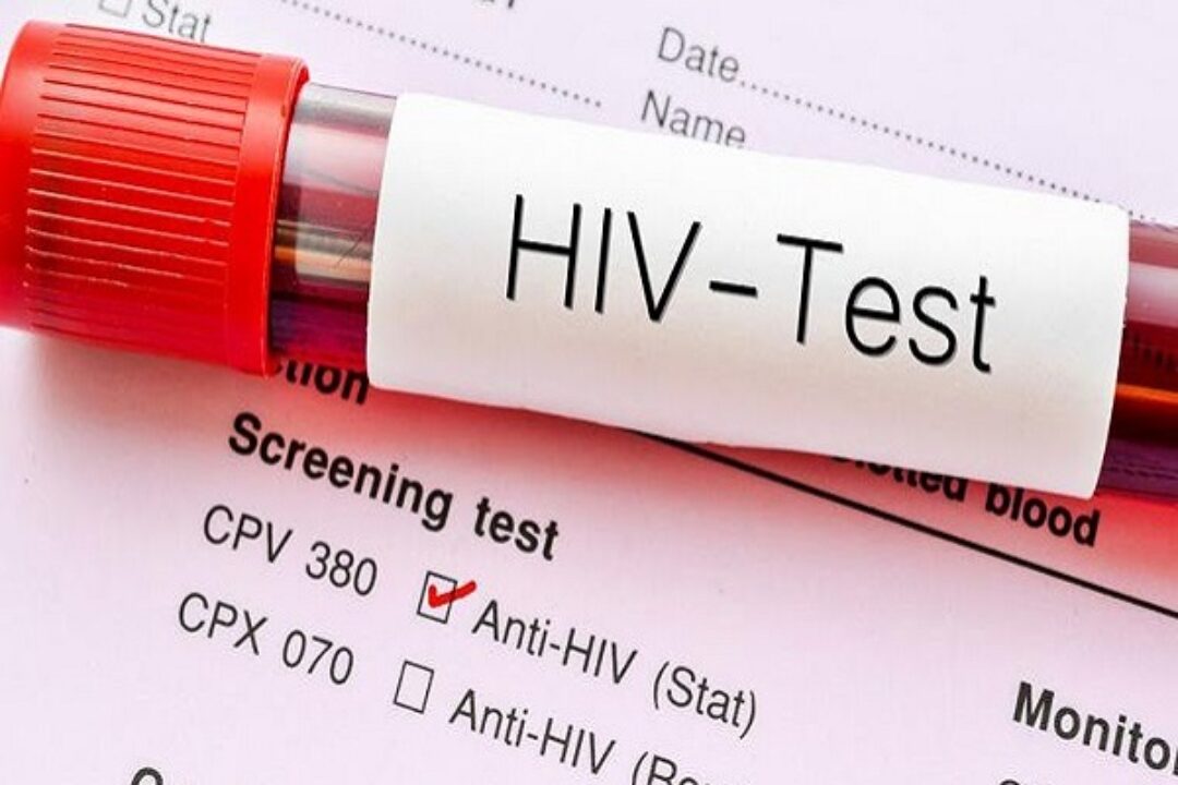 BEWARE!23,495 Ghanaians test positive for HIV in 6 months