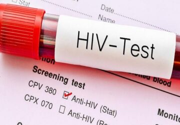 BEWARE!23,495 Ghanaians test positive for HIV in 6 months