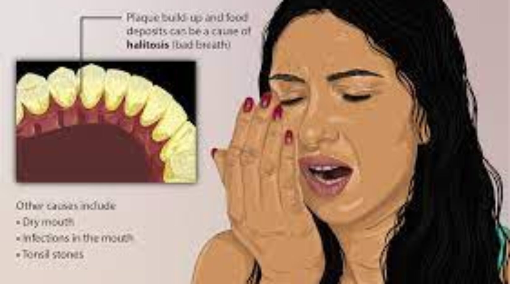 Dealing with Bad Breath (Halitosis)