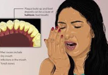 Dealing with Bad Breath (Halitosis)