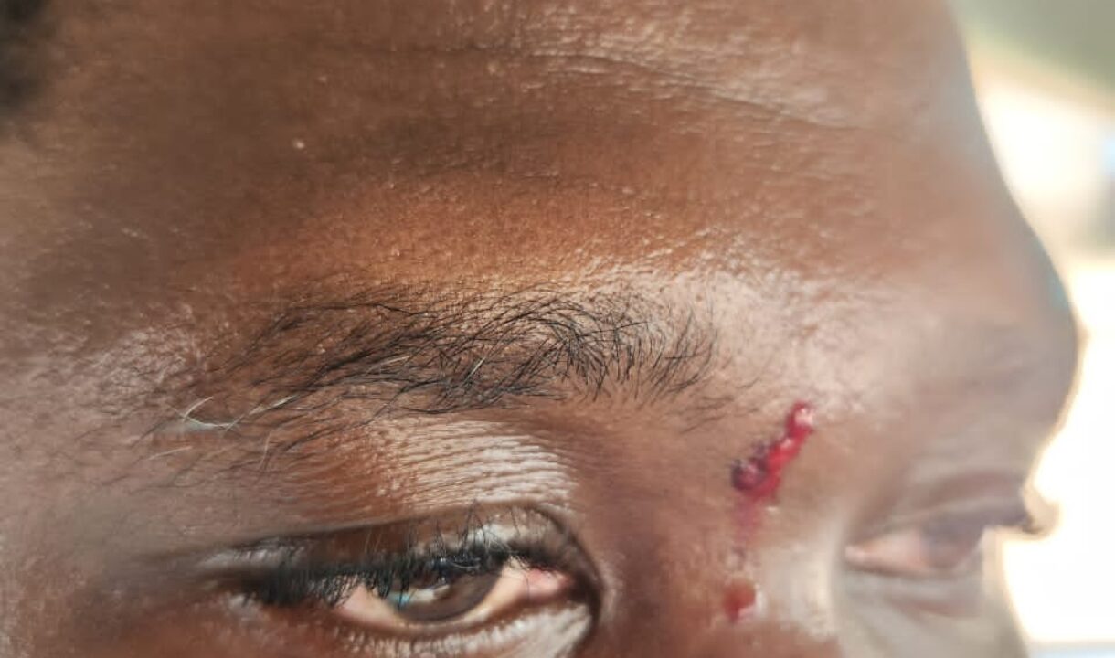GHone TV’s Lantam Papanko allegedly assaulted by National Chief Imam’s security on Ofankor road.