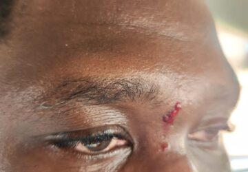 GHone TV’s Lantam Papanko allegedly assaulted by National Chief Imam’s security on Ofankor road.