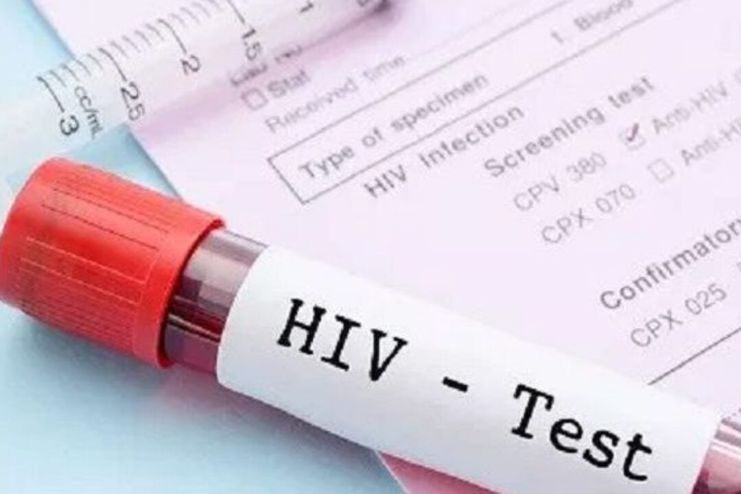 Ghana records nearly 14,000 new HIV infections in 2025 …As condom use declines
