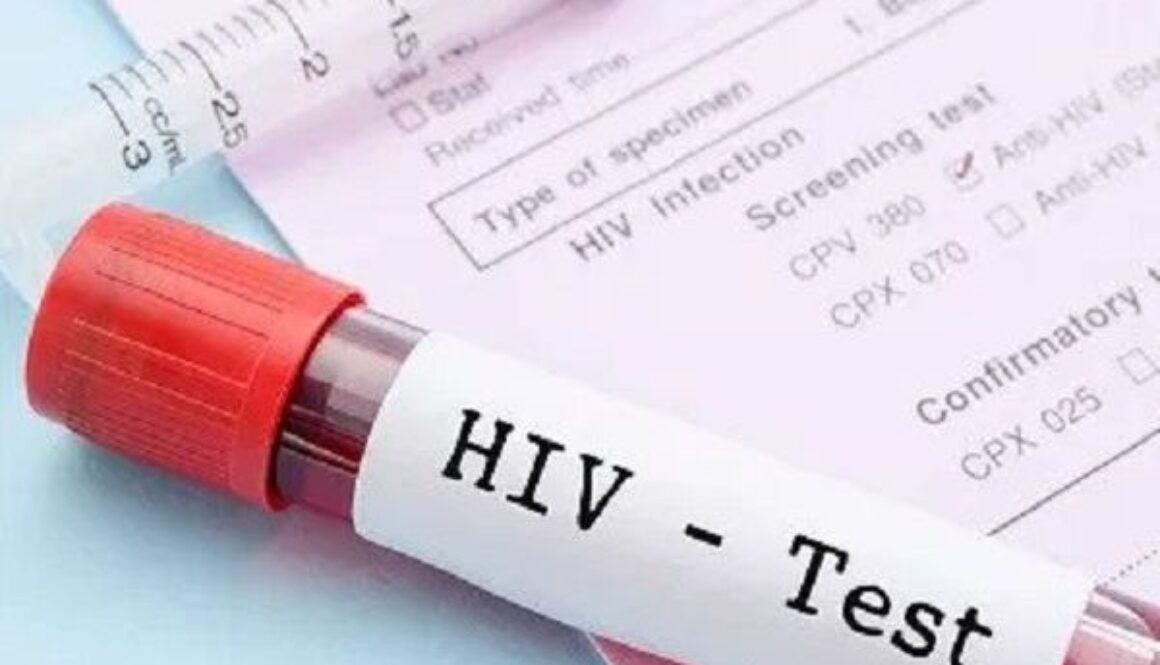HIV-test-