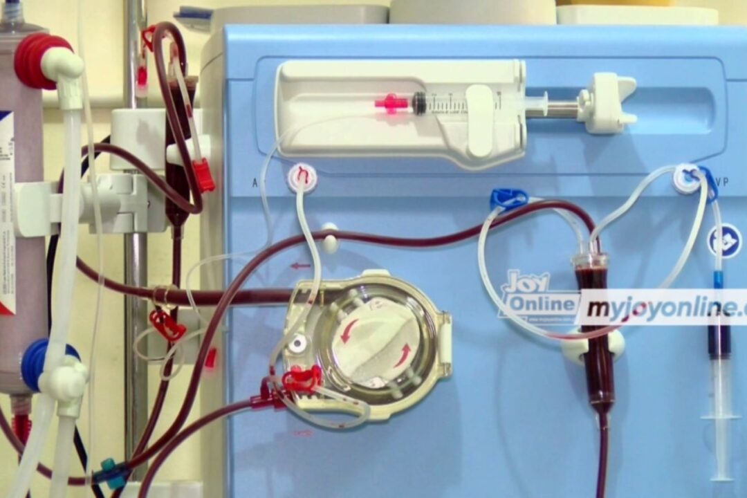 A/R: KATH receives highest disbursement in NHIA’s GH₵1m paid to hospitals for free dialysis programme