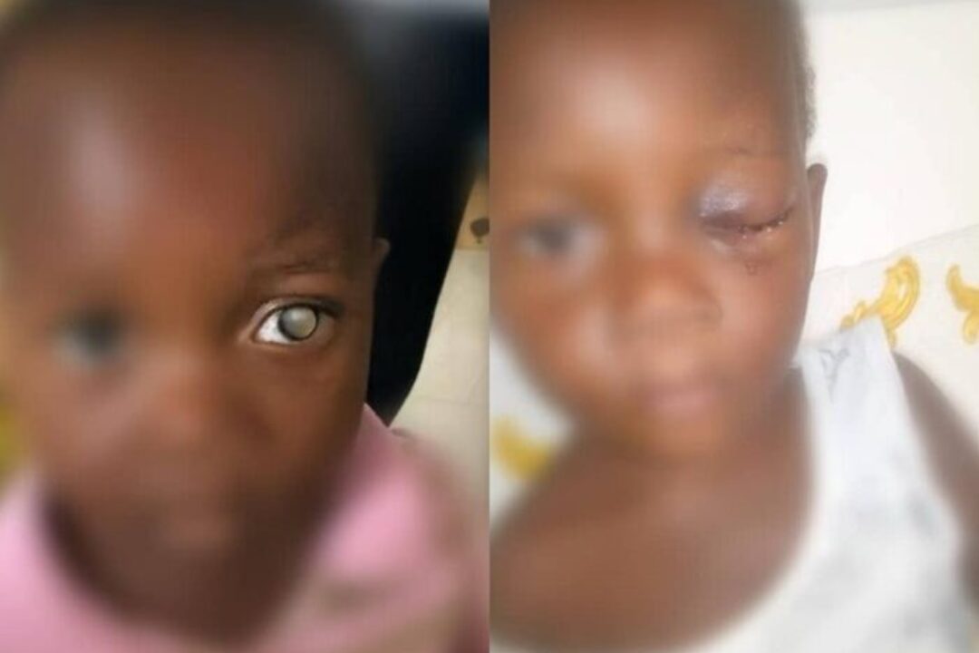 Kofi Job Foundation donates Ghc60,000 to save a 2-Year-old girl from blindness