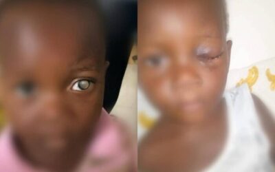 Kofi Job Foundation donates Ghc60,000 to save a 2-Year-old girl from blindness